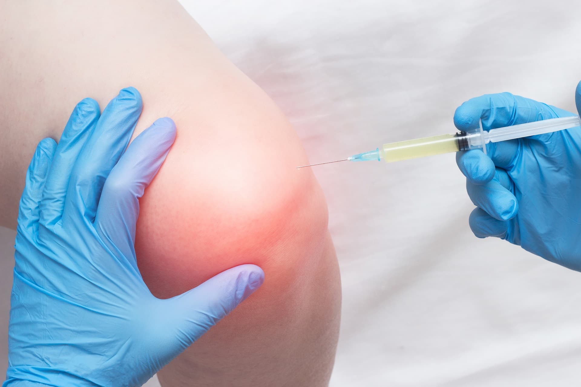 Joint Injections